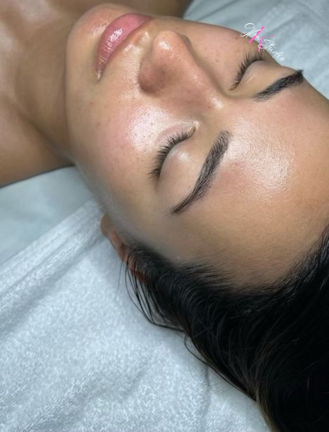 Facial1